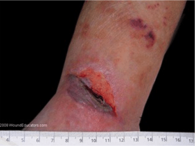 Dermatology - Wikipedia
