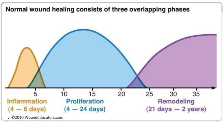 phases of wound healing