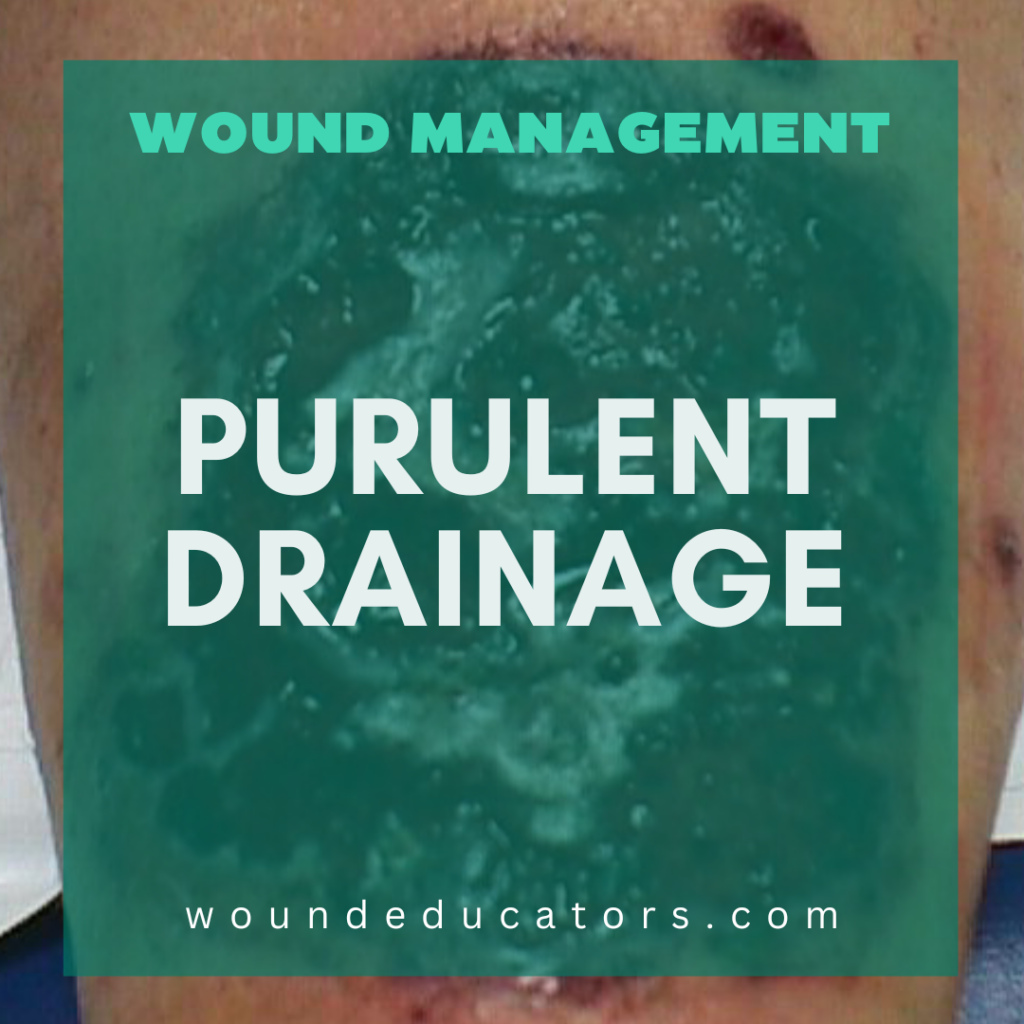 Purulent Drainage Wounds