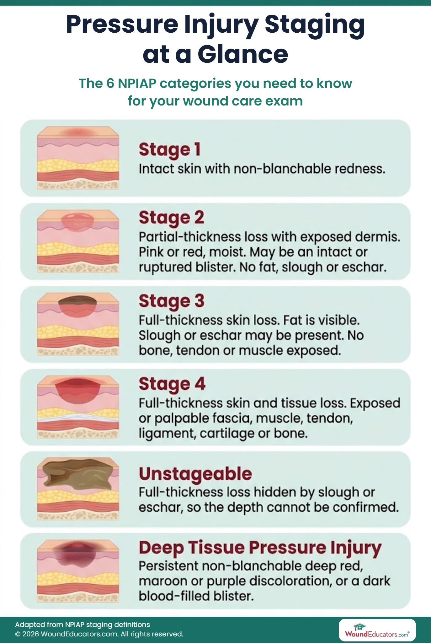 Pressure injury staging infographic showing Stage 1 to 4, unstageable and deep tissue pressure injury